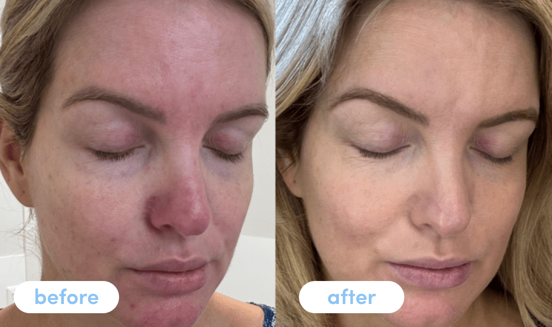 Hayley S - Taking Premium Collagen for 4 weeks - The Collagen Co.